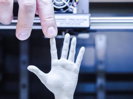 3d-printing-hand-finger-prosthetic-madurai